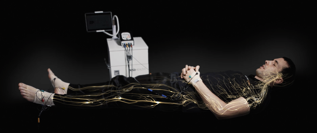 Neuromodulación no invasiva Nesa XSignal®